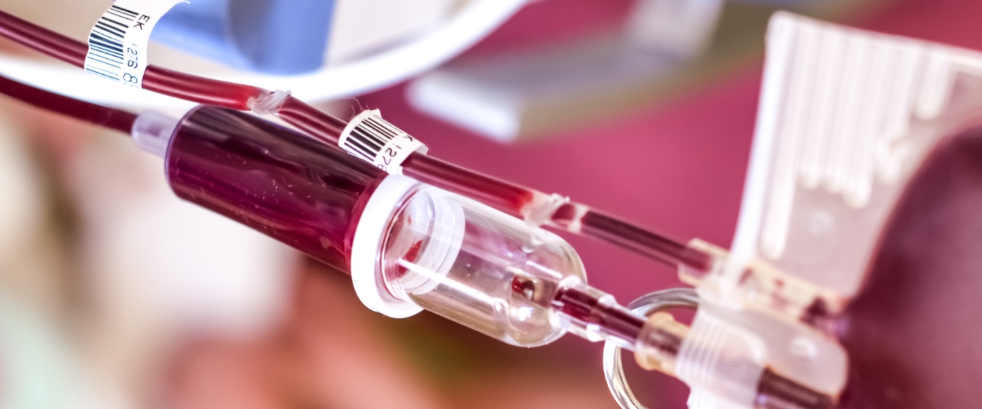 Photopheresis and Inactivation Systems